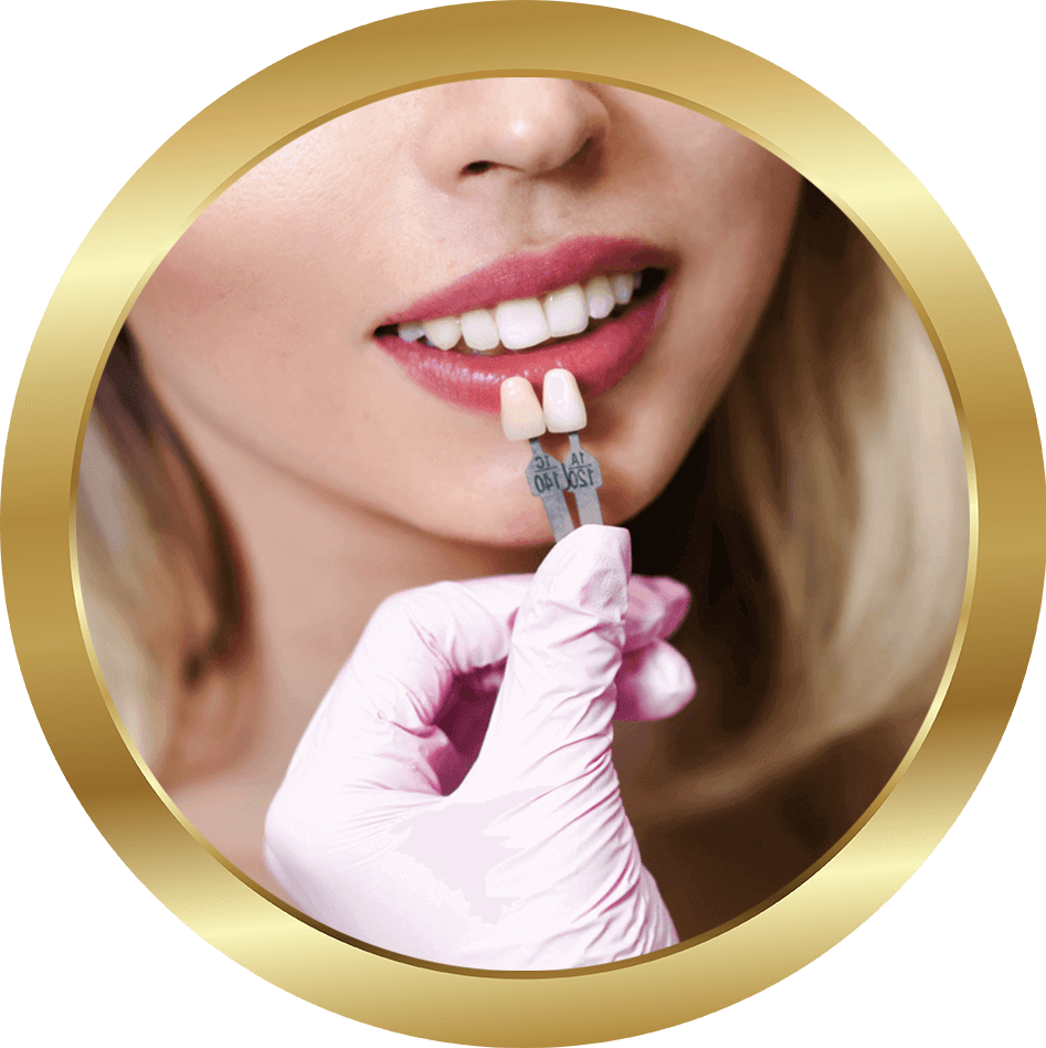 dental patient with veneers