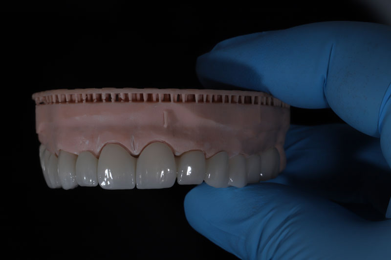 a full arch of teeth thats placed into the mouth